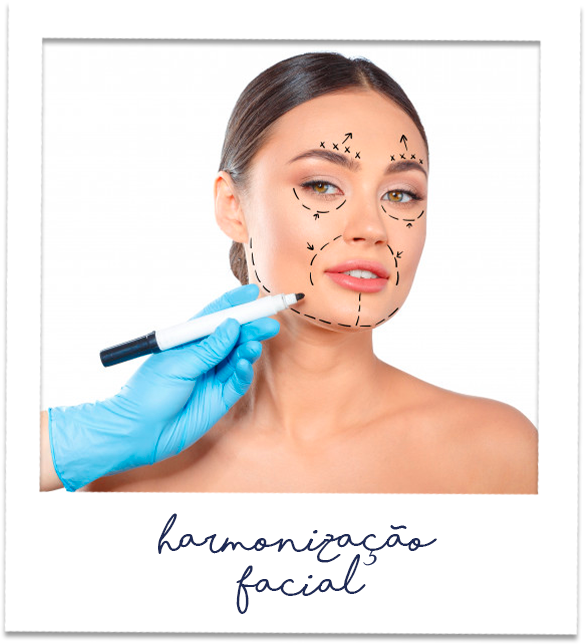 harmonização facial